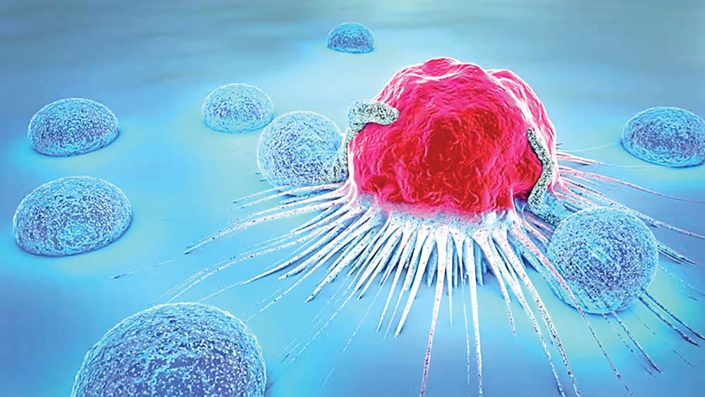 Cancer treatment